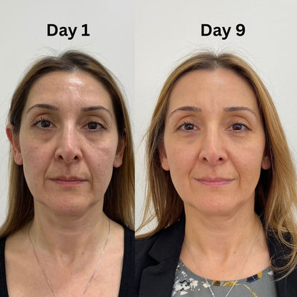 Volufiline Deep Collagen Cream In Serum