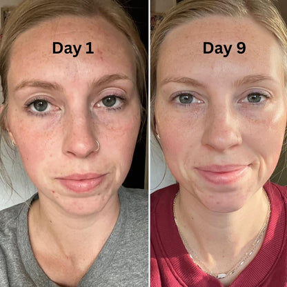 Volufiline Deep Collagen Cream In Serum