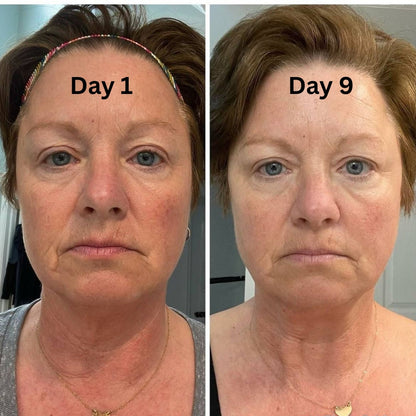 Volufiline Deep Collagen Cream In Serum