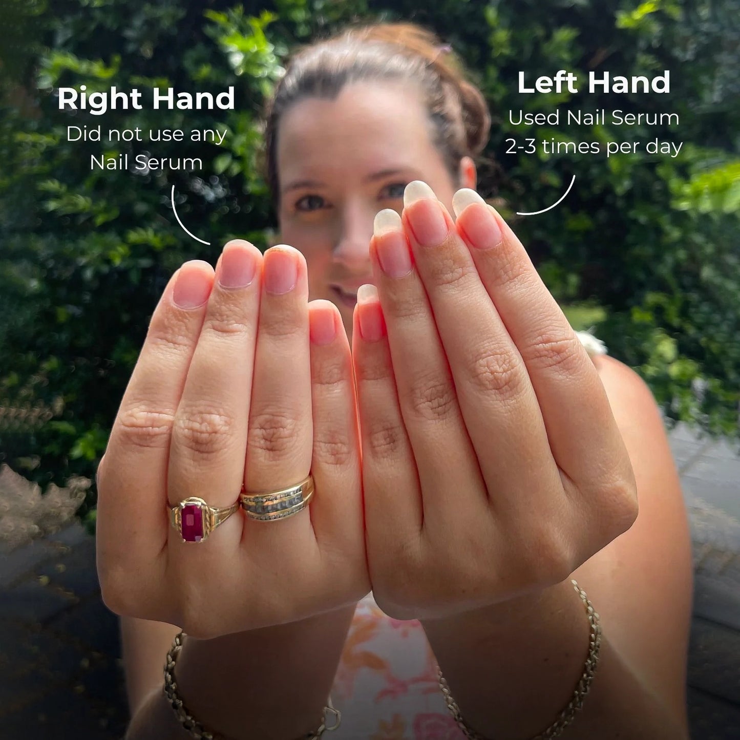 Stem Cells Nail Growth Pen